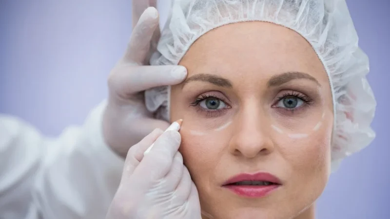 Can-Eyelid-Surgery-Cause-Eye-Problems_-A-Detailed-Explanation Can-Eyelid-Surgery-Cause-Eye-Problems_-A-Detailed-Explanation