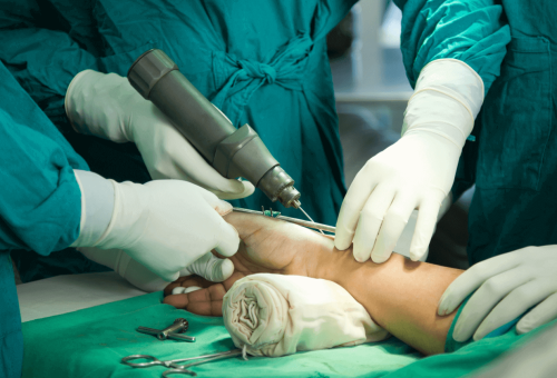Hand_Surgery_5c8b121e5f Hand_Surgery_5c8b121e5f