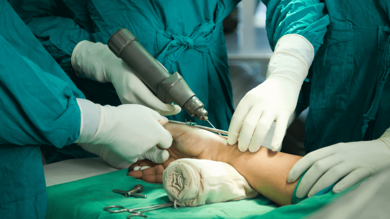 Hand_Surgery_5c8b121e5f Hand_Surgery_5c8b121e5f