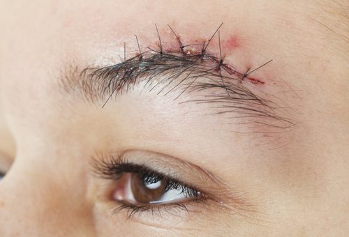 shutterstock_126377771 (1) shutterstock_126377771 (1)